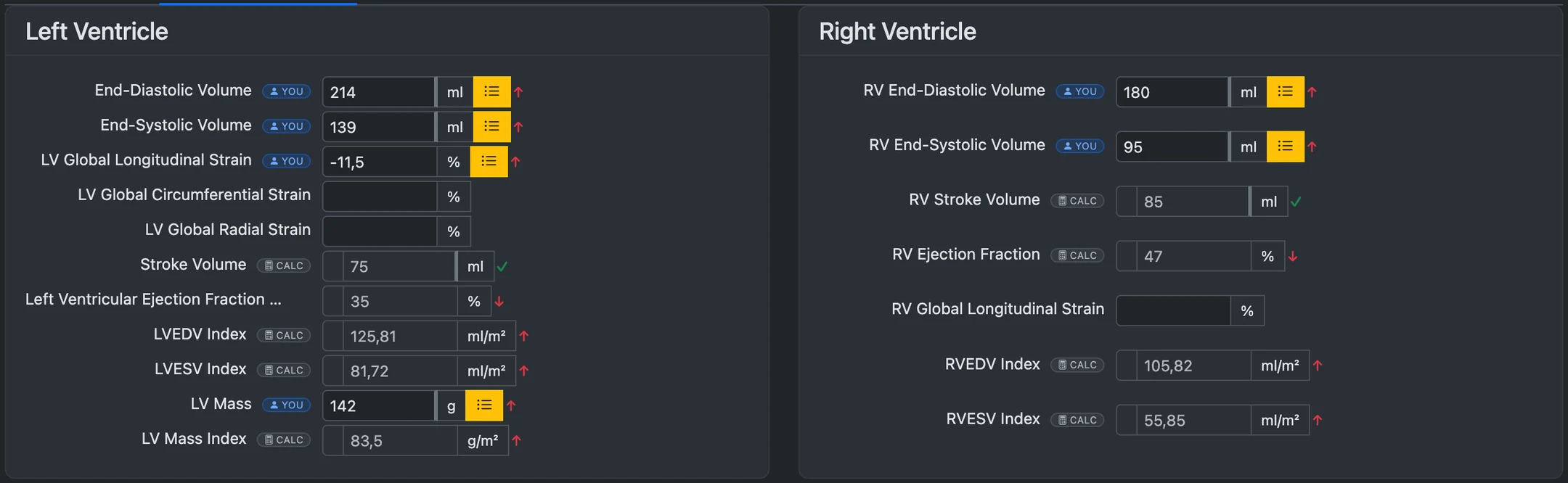 CMR structure and function tab: left and right ventricular volumes with origin badges, and stroke volume, ejection fraction and BSA-indexed values filled in by the calculation engine and flagged against reference ranges.